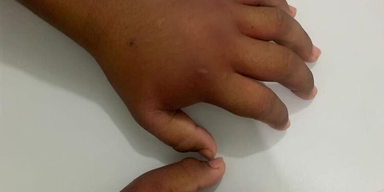 Maldade pura! Menino de 8 anos estava urinando sangue e com as mãos inchadas de tanta ‘ripada’
