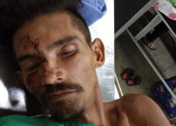 Hospital João Lúcio procura família de paciente internado após atropelamento