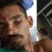 Hospital João Lúcio procura família de paciente internado após atropelamento