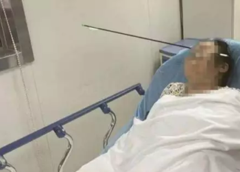 Mulher tem rosto atravessado por flecha de 70 centímetros