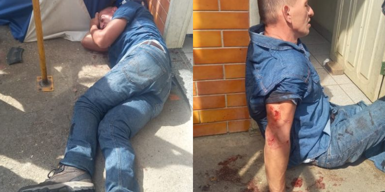Assaltante tenta roubar arma de vigilante no Balneário do Sesc-AM e acaba baleado