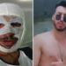 Homem diz que a ex jogou soda cáustica nele por não aceitar fim da relação