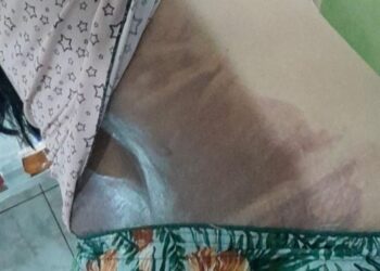 CENAS FORTES – Covarde joga água fervendo na esposa com filha no colo, em Manaus