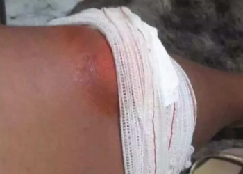 Mãe denuncia agressão de policial contra filho autista que chegou a defecar nas calças