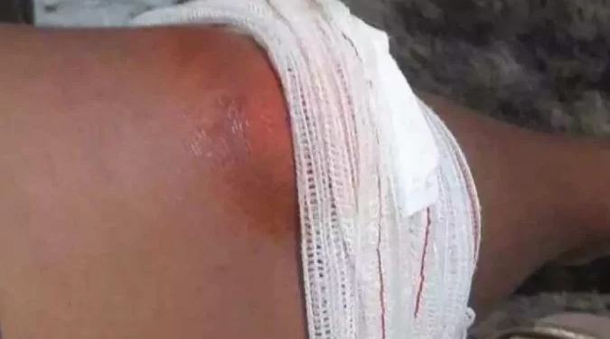 Mãe denuncia agressão de policial contra filho autista que chegou a defecar nas calças