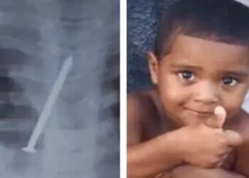 Menino morre com prego no pulmão e família acusa hospital de negligência: ‘nunca pediram exame’