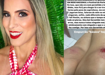 Milena, ex-BBB amazonense e torcedora do Garantido, diz que foi agredida em festa do Caprichoso