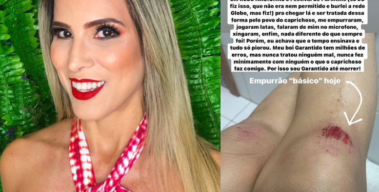 Milena, ex-BBB amazonense e torcedora do Garantido, diz que foi agredida em festa do Caprichoso