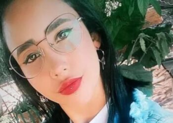 Após colocar piercing na boca, jovem morre com infecção no cérebro