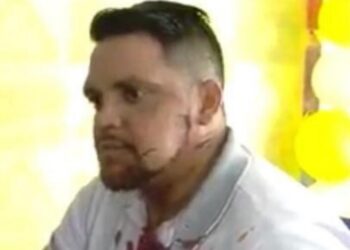 Empresário é assaltado, baleado e bate de frente com moto a caminho do hospital