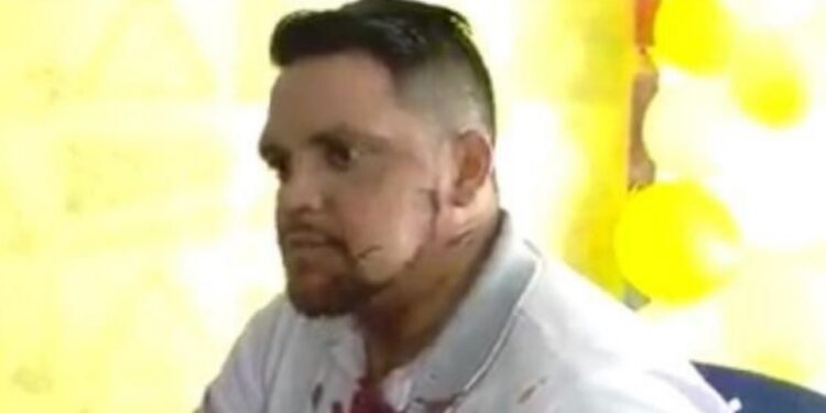 Empresário é assaltado, baleado e bate de frente com moto a caminho do hospital
