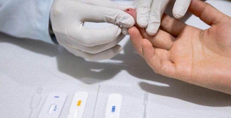 Prefeitura ofertará testes rápidos de hepatites B e C no Centro de Manaus