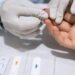 Prefeitura ofertará testes rápidos de hepatites B e C no Centro de Manaus
