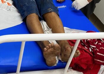 Homem vai almoçar em bar no Centro de Manaus e ganha tiros de ‘sobremesa’