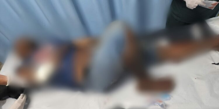 Homem é baleado e espancado com barra de ferro em Manaus