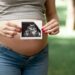 Senado aprova Lei que dispensa aval do marido para mulheres fazerem laqueadura