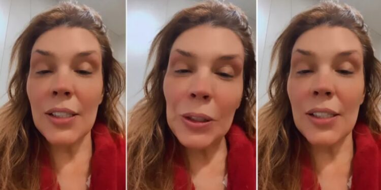 Simony enfrenta quimioterapia e tem fé que vai vencer o câncer: ‘já deu certo’