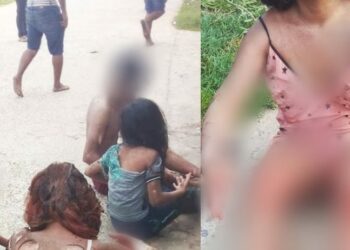 Incêndio: Botija de gás explode e 6 pessoas, sendo 3 crianças, ficam feridas no AM