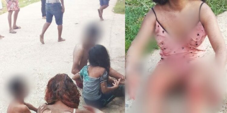 Incêndio: Botija de gás explode e 6 pessoas, sendo 3 crianças, ficam feridas no AM