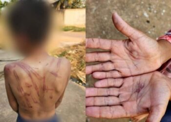 No Pará, mãe dá surra com galho de árvore no filho por causa de R$10