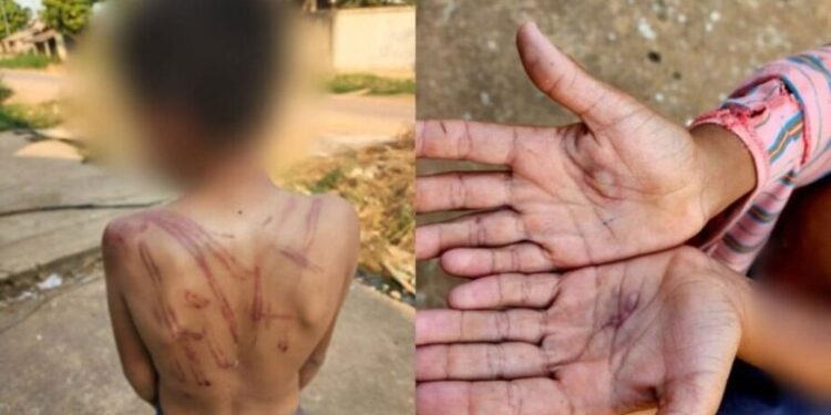 No Pará, mãe dá surra com galho de árvore no filho por causa de R$10