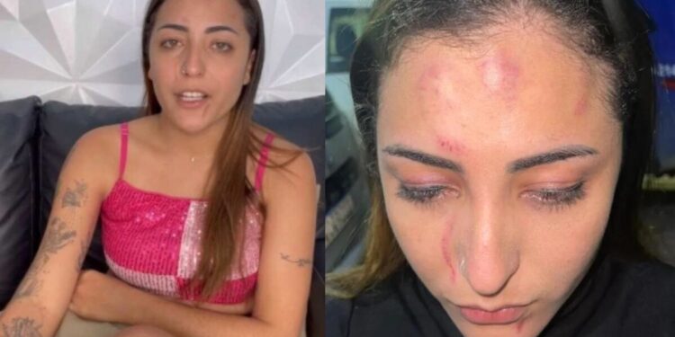 Vocalista da banda Sedutora é agredida a socos por casal