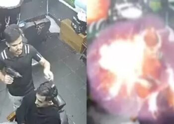 Cenas fortes: Secador explode na mão de barbeiro e ele se fere gravemente