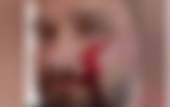 Médico é agredido com capacete ao negar atestado de três dias a paciente de 17 anos