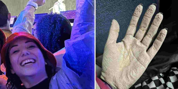Jovem viraliza ao mostrar mão cadavérica após enfrentar frio e chuva no Rock in Rio: ‘morreu, mas passa bem’