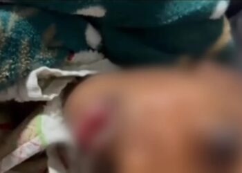 ‘Mamãe, um dia eu vou ficar branco?’, pergunta criança negra chamada de ‘cocô’ por colegas de escola