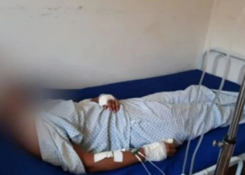 Doeu a cabeça: Homem sonha que estava sendo traído e dá facadas na esposa ao acordar