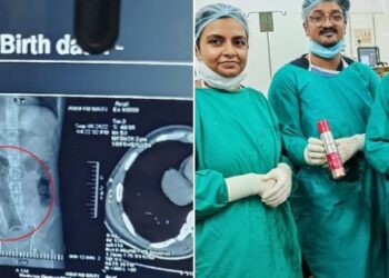 Jovem dá entrada no hospital com desodorante de 20 cm preso no ânus: ’20 dias sem evacuar’