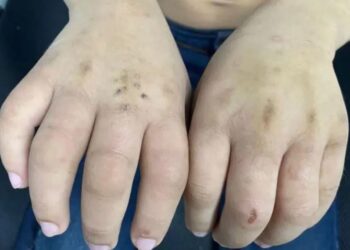 Mãe é presa suspeita de torturar o sobrinho de 8 anos em Manaus