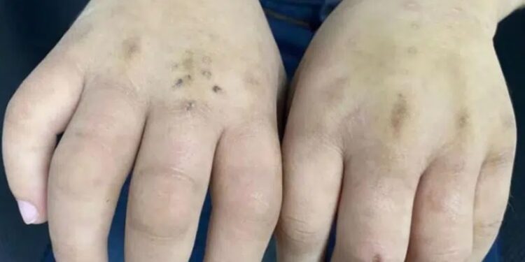 Mãe é presa suspeita de torturar o sobrinho de 8 anos em Manaus