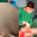 Médicos fazem cirurgia de emergência e retiram tumor de 46kg de paciente