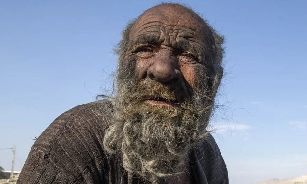 “Homem mais sujo do mundo” morre meses após tomar banho