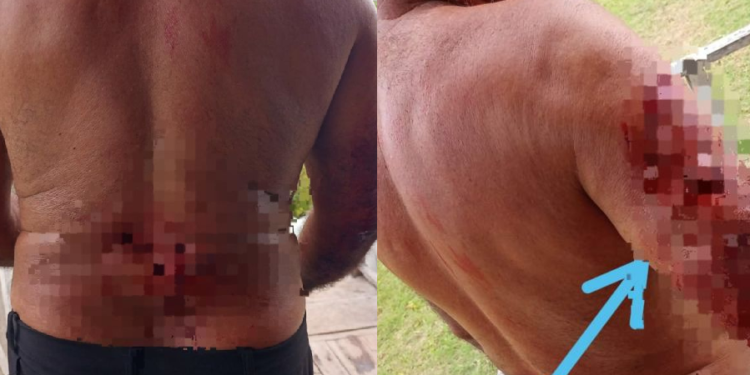 Vídeo: Homem é atacado por jacaré no AM e fica com parte do braço e costas dilacerados