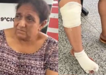 ‘Posso perder o pé’, diz idosa arrastada por motorista de aplicativo durante corrida em Manaus
