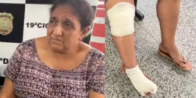 ‘Posso perder o pé’, diz idosa arrastada por motorista de aplicativo durante corrida em Manaus