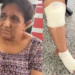 ‘Posso perder o pé’, diz idosa arrastada por motorista de aplicativo durante corrida em Manaus