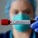 Número de óbitos no AM volta ao patamar anterior à pandemia de coronavírus