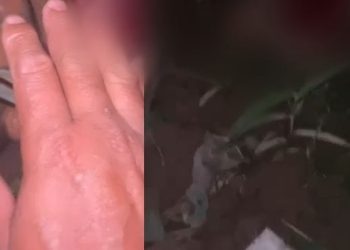 Vídeo: Com medo da morte e o peito aberto após ataque de onça em Manaus, homem ‘aceita Jesus’