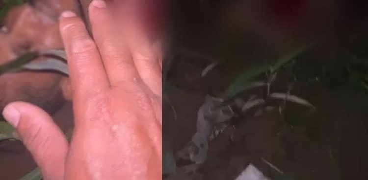 Vídeo: Com medo da morte e o peito aberto após ataque de onça em Manaus, homem ‘aceita Jesus’