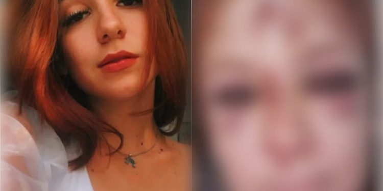 Jovem atropela onça e fica com rosto desfigurado após capacete se soltar