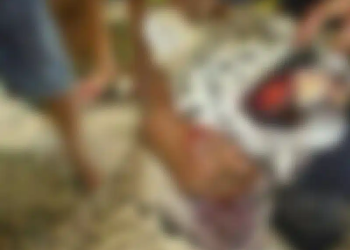 Vídeo: Ataque de onça no Iranduba deixa homem com o rosto rasgado