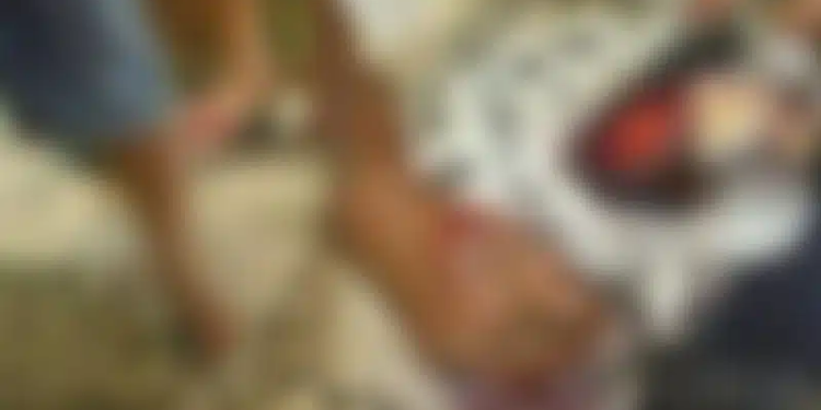 Vídeo: Ataque de onça no Iranduba deixa homem com o rosto rasgado