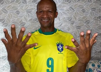 Brasileiro com seis dedos quer comemorar hexa com uma mão só: ‘ansioso’