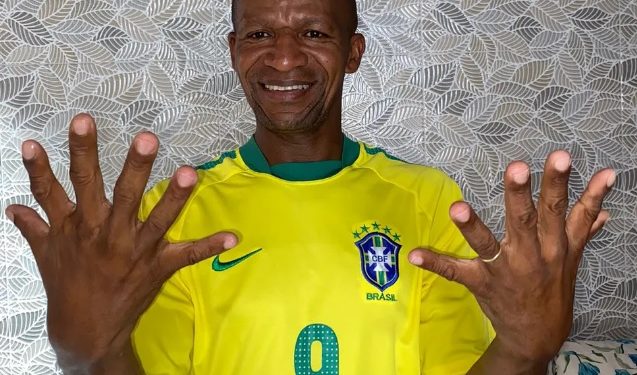 Brasileiro com seis dedos quer comemorar hexa com uma mão só: ‘ansioso’