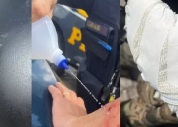 Polícia divulga fotos de ataque sofrido durante manifestação bolsonarista