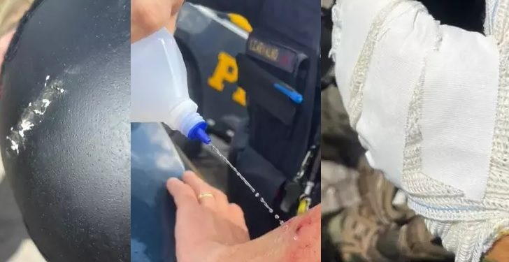 Polícia divulga fotos de ataque sofrido durante manifestação bolsonarista